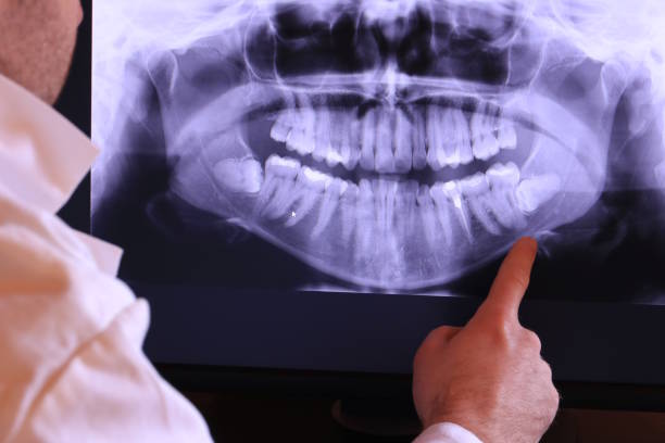 Best Dentist for Tooth Abscess  in Bren Arrow, OK