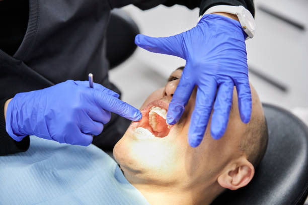 Best Emergency Gum Pain Relief  in Bren Arrow, OK